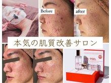 ホワイトアクア 四日市店(WHITE AQUA)の雰囲気（一人一人肌質改善プログラムをご提案させていただきます）