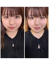 マナ(mana)/耳マッサージで小顔効果☆