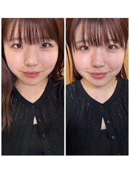 マナ(mana)/耳マッサージで小顔効果☆