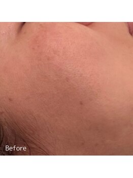 ククル(KUKULU)/陶肌トリートメントご来店時