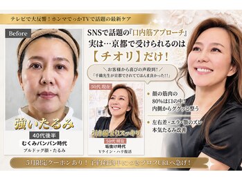 サロンチオリ 烏丸(Salon Chiori)の写真/糸リフトを考える前に！京都唯一の【口内筋ケア】内側からアイロンをかけたような若ハリ肌＆最速小顔へ