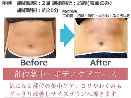 クリーン(clean)の写真