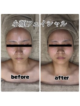 ブオン(Buom)の写真/《布施5分》むくみ撃退！【小顔フェイシャル・デコルテ+ヘッド60分￥￥10,800】で小顔へ★