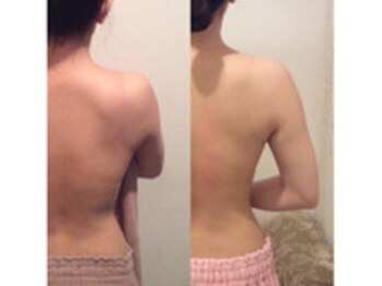 ヴィクトワール(Victoire)/３Dボディコルギ【肩こり特化】