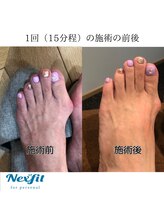 ネクスフィット(Nexfit)/『母趾の変形改善リリース』