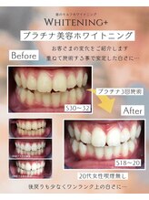 ホワイトニングプラス(Whitening+)/しっかり重ねていこう