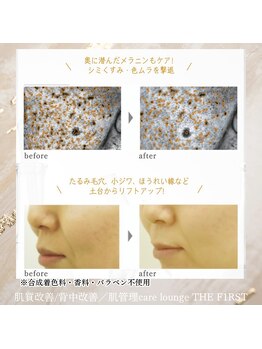 ケア ラウンジ ザ ファースト(THE F1RST)/オススメの美白美容液＊