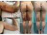 《都度払いインディバ術後ケア》背中/腰/太もも/二の腕など指定部位集中 90分