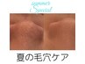 【夏本番★毛穴スペシャル】サロン専用ピーリングで毛穴ツルツル　3800円