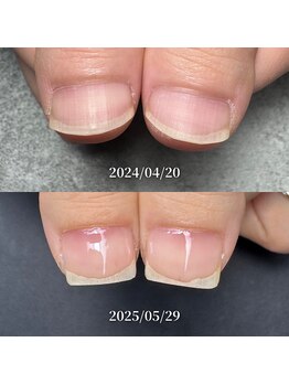 ココ(COCO)/ハンドケア・ネイルケア・爪育成