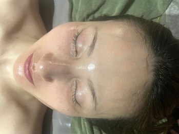 サロンドシュシュ 心斎橋本店(salon de chouchou)/REVIハーブピーリング