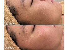 アイティス(Salon Its)/【Before &After】