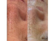 ミラ ナガマチ(milla nagamachi)の雰囲気（個室エステメニューも人気です♪）