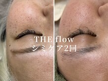 ザ フロウ(THE flow)/シミケア2回｜before/after