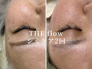ザ フロウ(THE flow)/シミケア2回｜before/after
