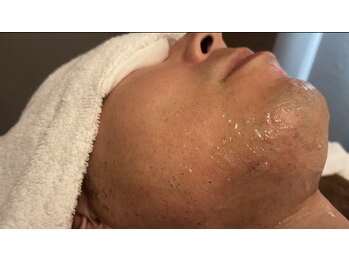 ビーモア(be MoA)の写真/メンズ脱毛はプロにお任せ！ひげVIOや濃い毛もケアする施術を体験◎