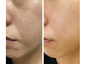 ペリドット(Peridot)/