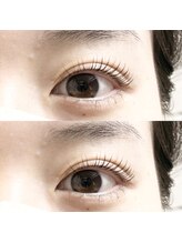 abp /ラッシュリフト