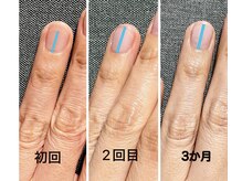 ネイルサロン ルージュ(Nail Salon Rouge)の雰囲気（深爪、チビ爪でお悩みの方はまずカウンセリングから）