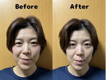 くにたちNyan鍼灸整体院/【小顔矯正】Before After 10