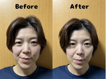 くにたちNyan鍼灸整体院/【小顔】Before After 10