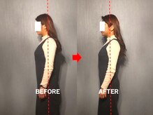 アトラス/初回のお客様のBefore＆after