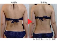 サンティエ(Santie)の雰囲気(【痩身・ブライダル痩身実績多数】徹底ケアで美しいシルエットへ)