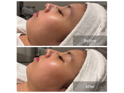 ポーラ ふじと台駅前店(POLA)の写真