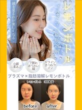 ビューティークリニーク アマーレ(Amare)
