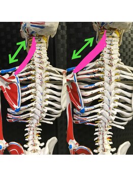 太陽整体室/肩が凝る肩甲骨の歪み