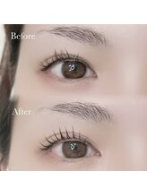 ハリス(HARIS)/ビフォーアフター