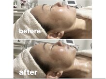 ママニエ(ma maniere)/【最上級のエステ光フォト】