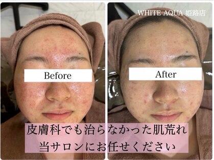 ホワイトアクア 姫路店(WHITE AQUA)の写真