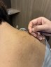 【川村限定メニュー】お灸たっぷりコース 6600円→