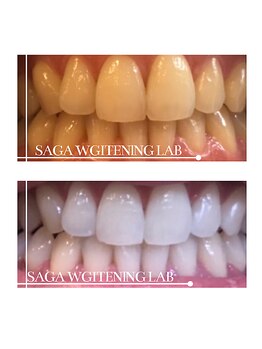 佐賀ホワイトニングラボ/