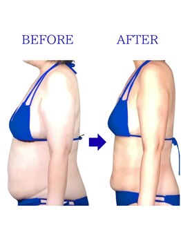 エクレボーテ(ECOULERBEAUTE)の写真/京橋終了5月まで|本気で変わるサイズダウンリンパ