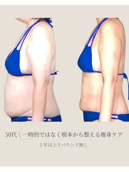 エクレボーテ(ECOULERBEAUTE)の写真/写真：1年以上リバウンド無し｜年齢と共に痩せにくくなった身体を深く整える痩身ケア