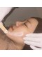 ミア(miiia)の写真/【フェイスWAX】お顔の産毛&角質ケアでトーンUP♪さらにリフトUPまで叶える◎顔ダニも除去しニキビケアも!