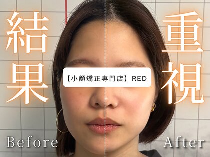 レッド(RED)の写真