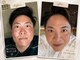 ケイ エムワン(K M1)の写真/【しわ・たるみ改善】世界初の人型コラーゲン×幹細胞の力で、本格エイジングケア体験♪