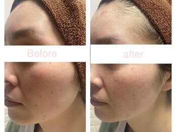 サクラ 伊勢原店(SAKURA)/こんなに【変化】するとは（笑）