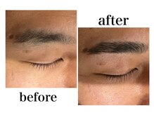 カイル 横浜(Kyle.)/メンズ脱毛&眉毛サロン 横浜ひげ