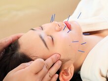 キンモクセイ鍼灸治療院(kinmokusei鍼灸治療院)/美容鍼