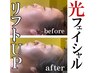 【人気急上昇中★】あご肉撃退◆モチ◎美肌ライトフェイシャル　¥7000