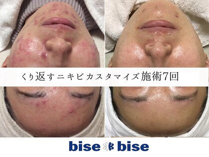 ビズビズ 天王寺店(bisebise)の写真