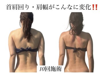 痩身革命 大宮店/ダイエットリンパマッサージ