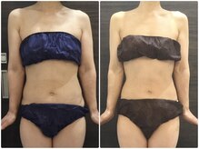 美容整体 ウェリナ 蟹江院/小顔矯正/骨盤矯正/美脚サロン 