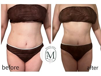 ミヨン(Miyong)/お腹スッキリ！　ボディ90分5回