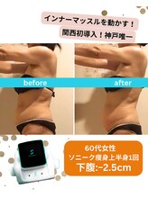 ボディデザインホームクレアフェリーチェ 神戸(Body design home Crea felice)/唯一無二☆業界初！ソニーク痩身