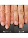自爪育成3ヶ月コース
